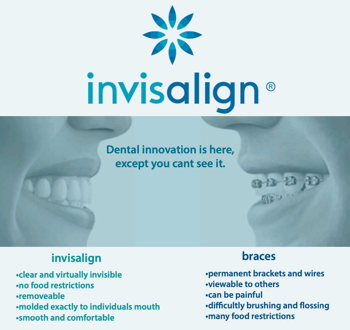 Best Invisalign Near Me Atlantic Beach, NY