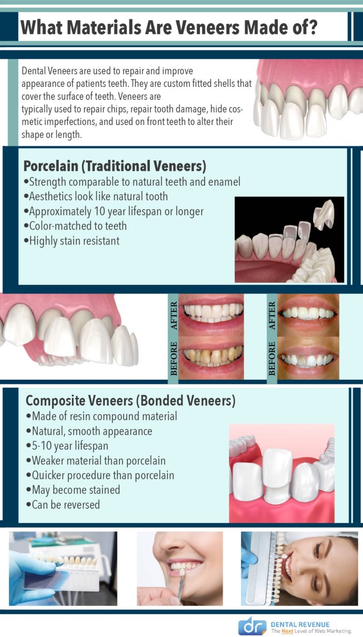 Composite bonding how our dentist uses UV cured resins